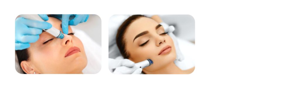 HydraFacial