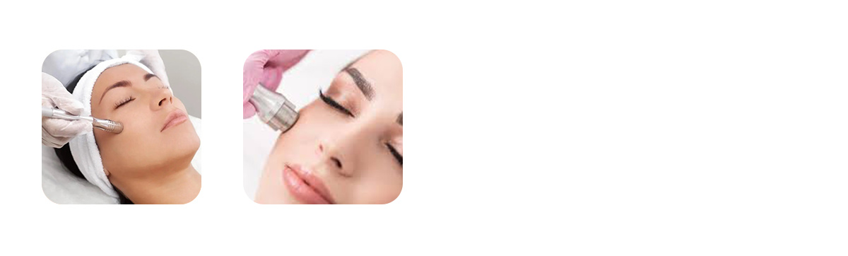 Microdermabrasion
