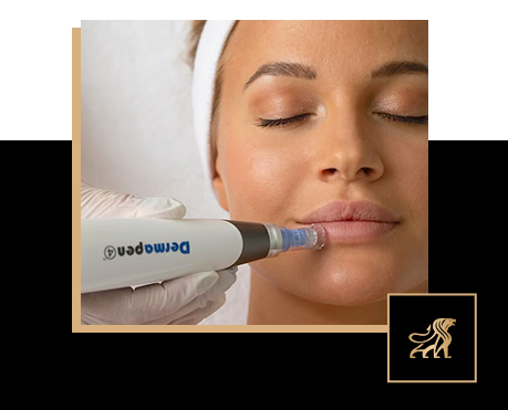 Why We Trust Dermapen 4 at Augusté Skin | Microneedling
