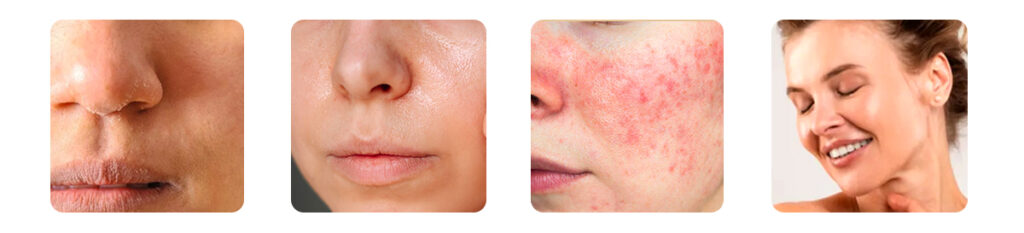 know your skin type