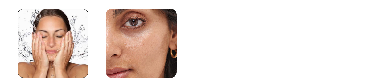 hyaluronic acid