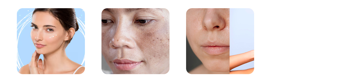 niacinamide