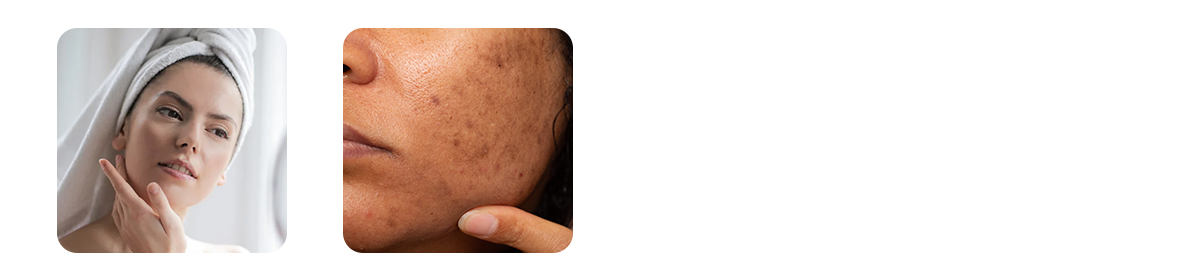 retinol