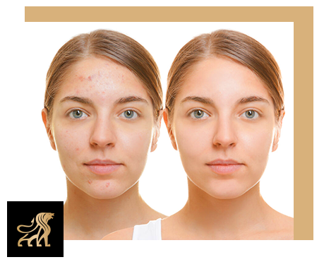 How HydraFacial Helps with Hydration, Lifting, and Skin Glow