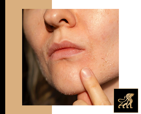 can dry skin make us age faster main image