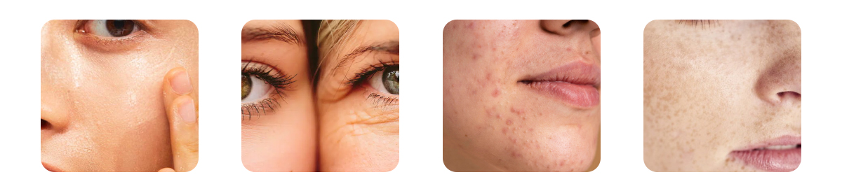 how dry skin accelerates ageing