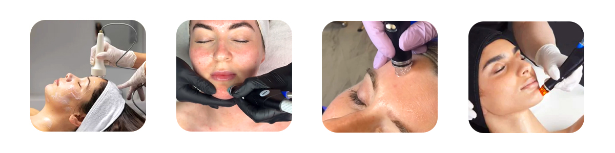 how hydrafacial works