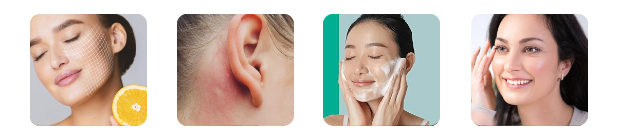 how to prevent breakouts when using vitamin c one to four