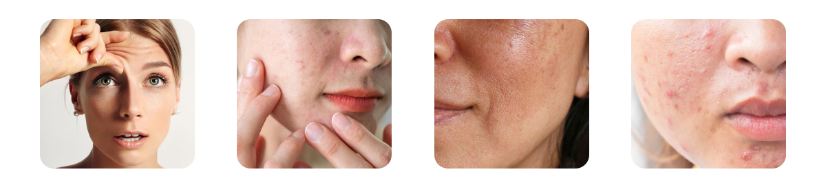 signs your dry skin is ageing faster