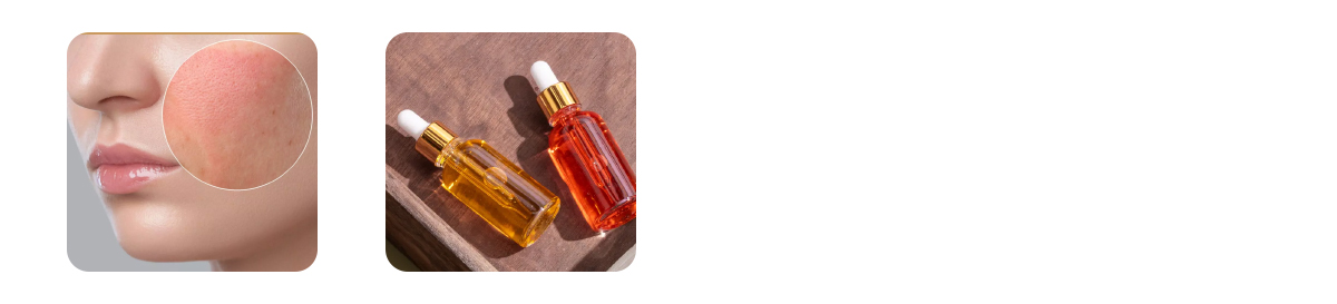 storage and oxidation issues