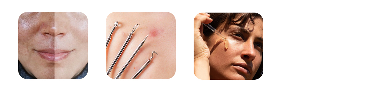 What exactly is a HydraFacial