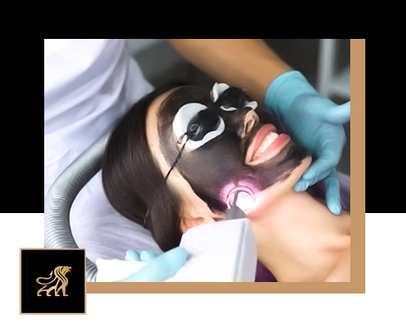 Best Carbon Q-Switch Laser Guide 2025 for Instant Glow