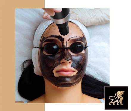 Hollywood Carbon Q Tone in Bangalore for Acne, Pores & Tan