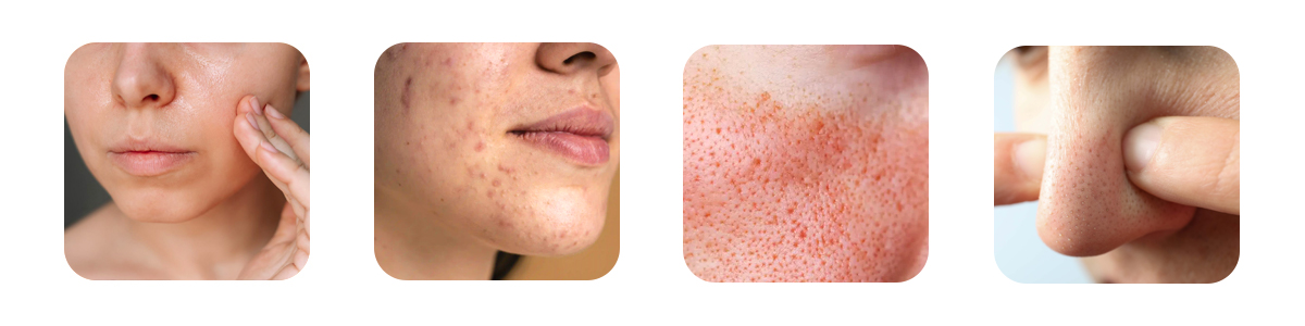 who is hollywood carbon q tone perfect for