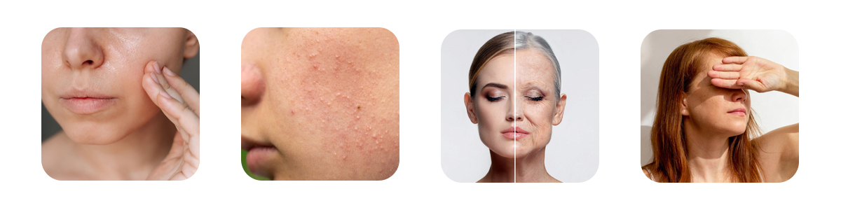 why do open pores appear on the face