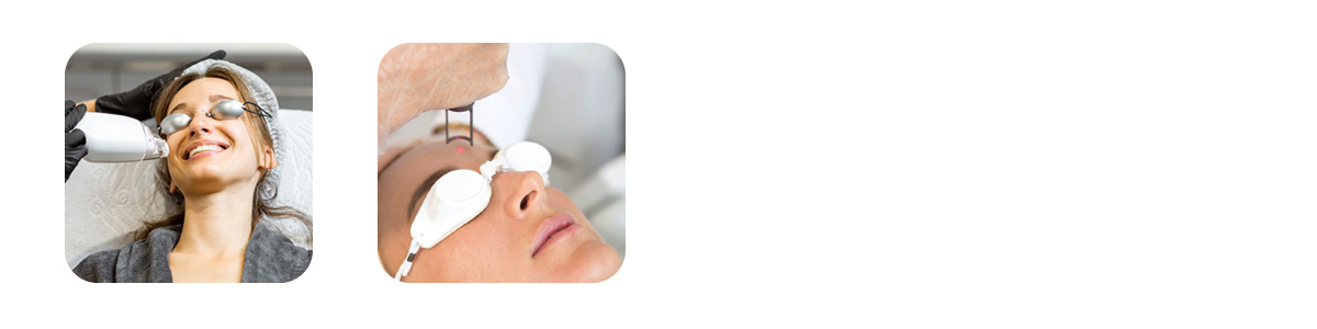 why nd yag q switch laser matters