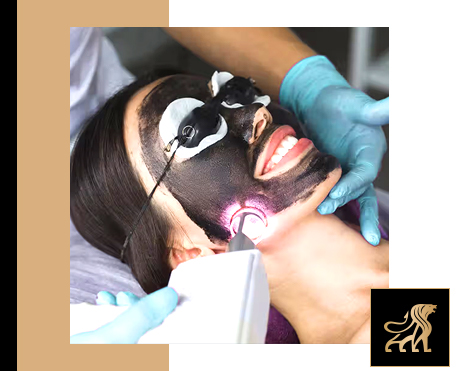 Why Carbon Laser Peel Is Your Shortcut to Glowing Skin