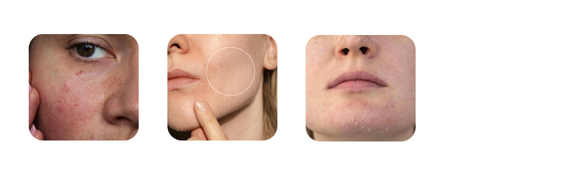 why dehydration is not synonymous