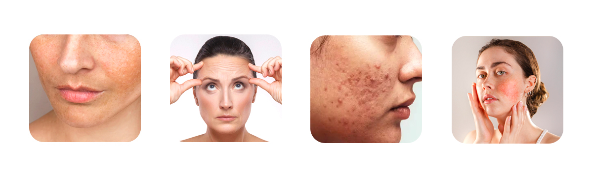 early warning signs of pollution affected skin 