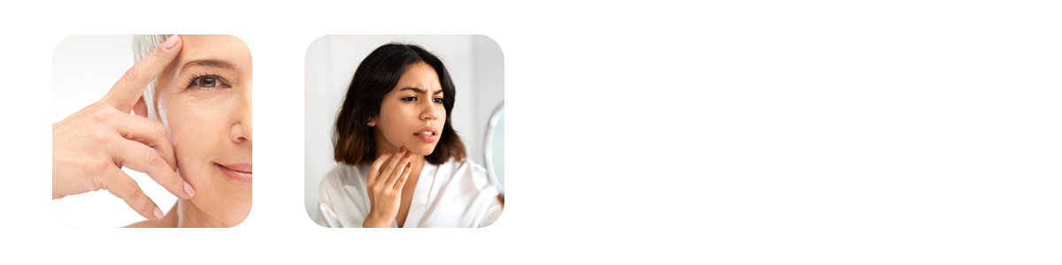 the process of glycation hidden damage to your skin