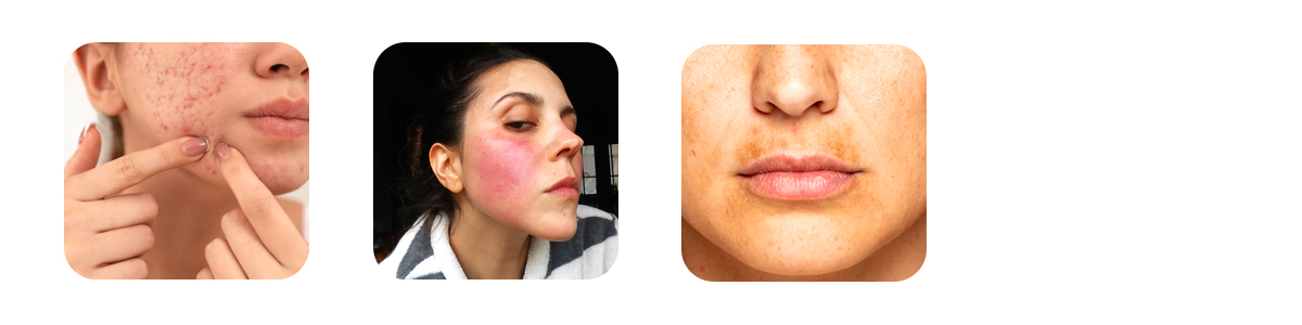 what is inflammation and why does it matter