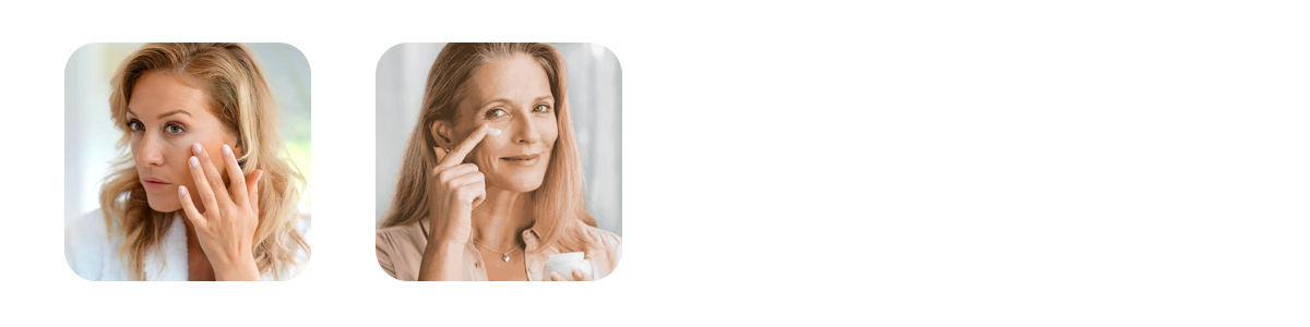 early signs of aging