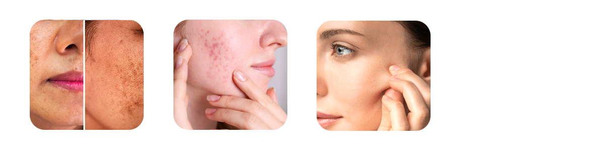 augusté skin a specialist skin clinic near shanthala nagar