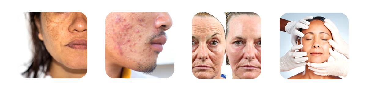 popular treatments for common skin concerns