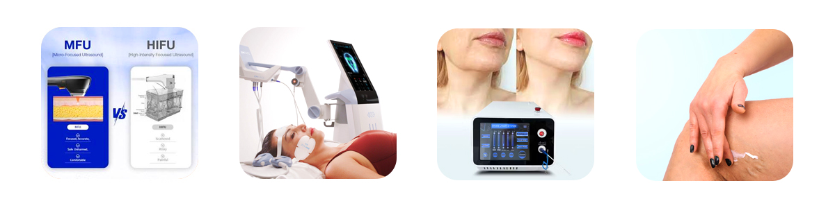 hifu vs endolift quick comparison