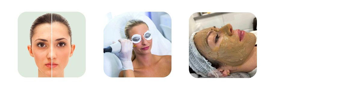 how auguste skin approaches pigmentation