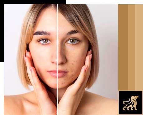 pigmentation treatment in bangalore auguste skin