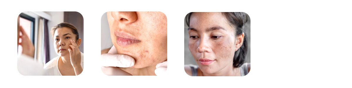who should get a hydrafacial