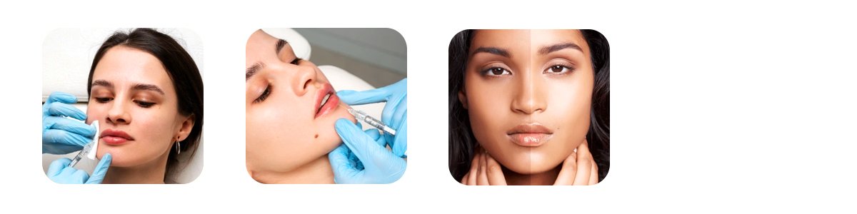 how auguste skin approaches lip pigmentation