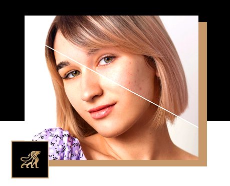Skin Purging vs Breakout: How to Actually Tell the Difference