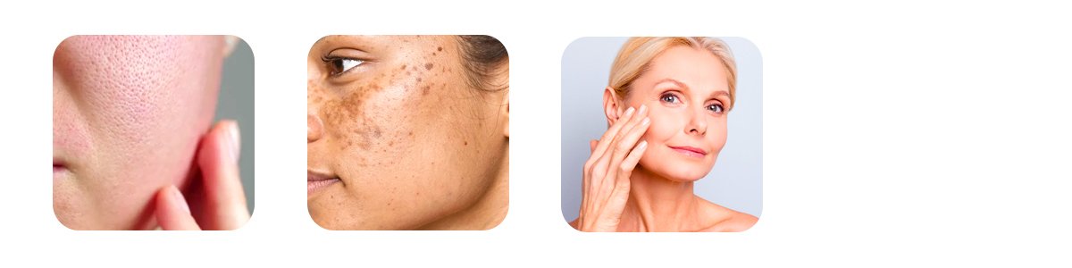 when a facial kit isnt enough