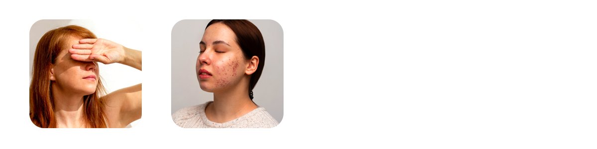why pigmentation is so common