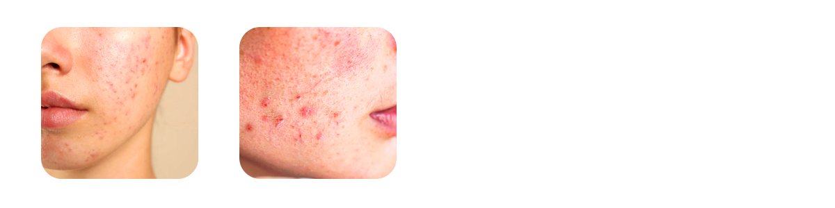what the skin barrier